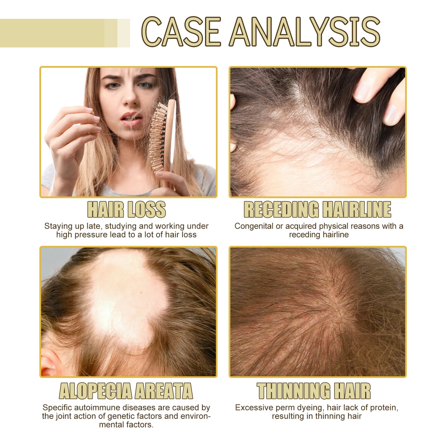 Rosemary Dense Hair Essential Oil for Repairing Damage, Preventing Hair Loss, and Softening Hair