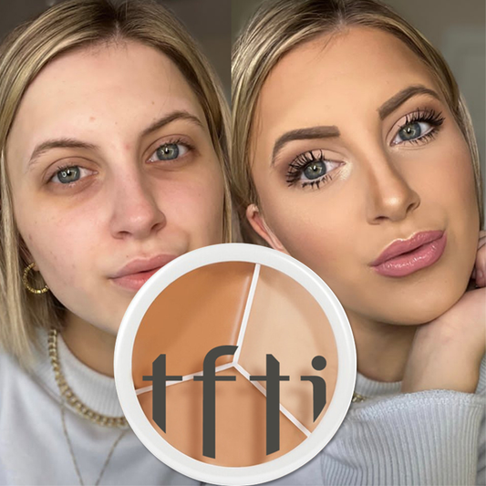 TFTI Three Colors Concealer: Concealer Palette for Covering Facial Spots, Acne Marks, and Dark Circles.